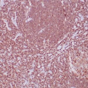 Immunohistochemistry (IHC) : Formalin-fixed, paraffin-embedded human lymph node stained with anti-CD45 (LCA) antibody using  peroxidase-conjugate and DAB chromogen. Note cell membrane staining of B- and T-lymphocytes.