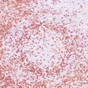 Immunohistochemistry (IHC) : Human lymph node stained with anti-CD45RO antibody using peroxidase-conjugate and DAB chromogen. Note cell membrane staining of T lymphocytes.