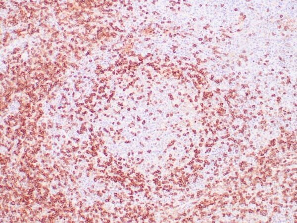 Immunohistochemistry (IHC) : Human lymph node stained with anti-CD45RO antibody using peroxidase-conjugate and DAB chromogen. Note cell membrane staining of T lymphocytes.