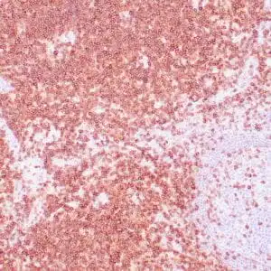 Immunohistochemistry (IHC) : Human tonsil  stained with anti-CD5 antibody using peroxidase-conjugate and DAB chromogen. Note cell membrane staining of T cells.