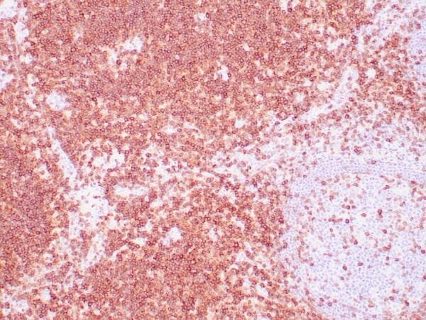 Immunohistochemistry (IHC) : Human tonsil  stained with anti-CD5 antibody using peroxidase-conjugate and DAB chromogen. Note cell membrane staining of T cells.