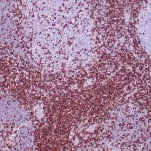 Immunohistochemistry (IHC) : Human tonsil stained with anti-CD5 antibody using peroxidase-conjugate and DAB chromogen. Note cell membrane staining of T-cells and no stain of B-cells.