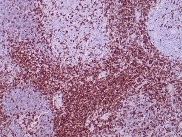 Immunohistochemistry (IHC) : Human tonsil stained with anti-CD5 antibody using peroxidase-conjugate and DAB chromogen. Note cell membrane staining of T-cells and no stain of B-cells.