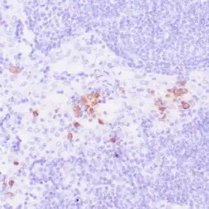Immunohistochemistry (IHC) : Human tonsil stained with anti-CD57 antibody using peroxidase-conjugate and DAB chromogen. Note intense cell membrane staining of natural killer cells.