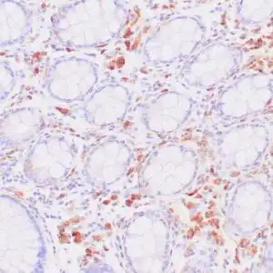 Immunohistochemistry (IHC) : Human colon stained with anti-CD68 antibody using peroxidase conjugate and DAB chromogen. Note intense cytoplasmic staining of glandular cells.