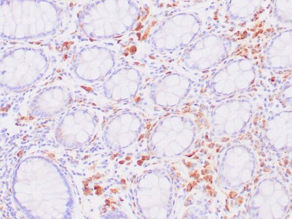 Immunohistochemistry (IHC) : Human colon stained with anti-CD68 antibody using peroxidase conjugate and DAB chromogen. Note intense cytoplasmic staining of glandular cells.