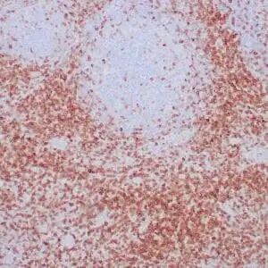 Immunohistochemistry (IHC) : Formalin-fixed paraffin-embedded human tonsil stained with anti-CD7antibody using  peroxidase-conjugate and DAB chromogen. Note cell membrane staining of perifollicular T-cells cell