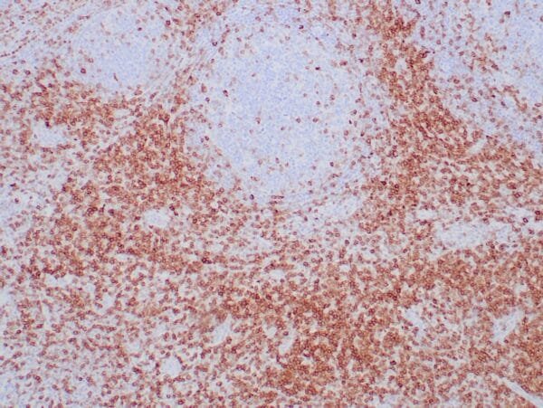 Immunohistochemistry (IHC) : Formalin-fixed paraffin-embedded human tonsil stained with anti-CD7antibody using  peroxidase-conjugate and DAB chromogen. Note cell membrane staining of perifollicular T-cells cell