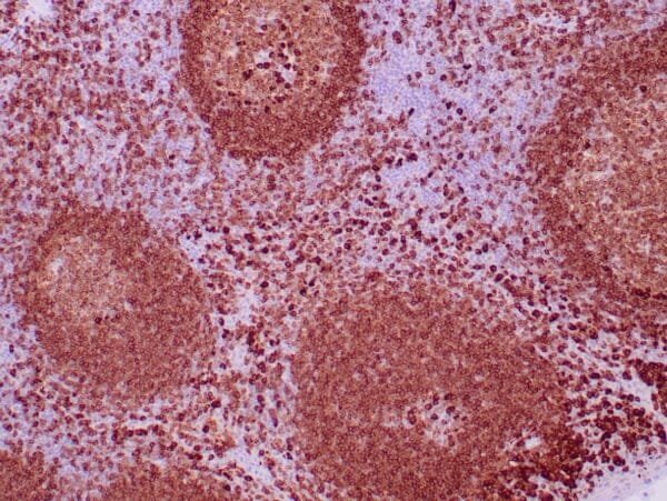 Immunohistochemistry (IHC) : Human tonsil stained with anti-CD79a antibody using peroxidase-conjugate and DAB chromogen. Note the cytoplasmic staining of follicular center and parafollicular B-cells.