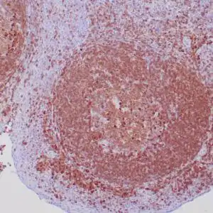 Immunohistochemistry (IHC) : Human tonsil stained with anti-CD79a antibody using peroxidase-conjugate and DAB chromogen. Note the cytoplasmic staining of follicular center and parafollicular B-cells.