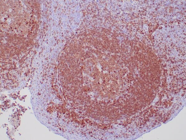 Immunohistochemistry (IHC) : Human tonsil stained with anti-CD79a antibody using peroxidase-conjugate and DAB chromogen. Note the cytoplasmic staining of follicular center and parafollicular B-cells.