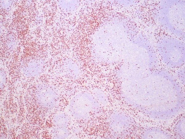 Immunohistochemistry (IHC) : Human tonsil stained with anti-CD8 antibody using peroxidase-conjugate and DAB chromogen. Not the membrane staining of perifollicular T-cells.