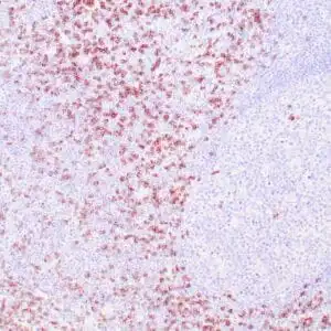 Immunohistochemistry (IHC) : Human tonsil stained with anti-CD8 antibody using peroxidase-conjugate and DAB chromogen. Not the membrane staining of perifollicular T-cells.