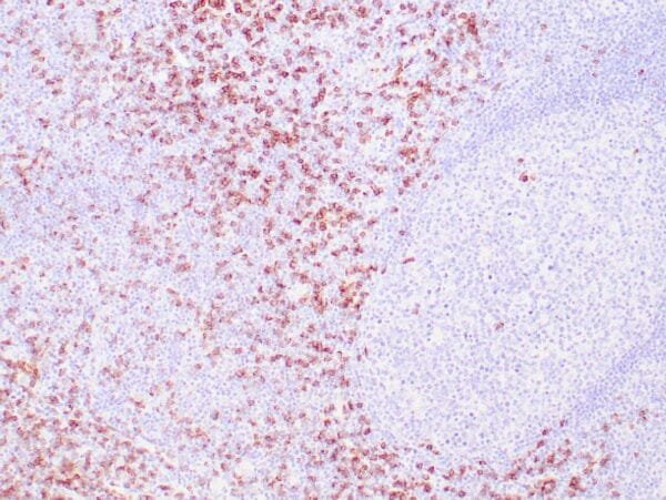 Immunohistochemistry (IHC) : Human tonsil stained with anti-CD8 antibody using peroxidase-conjugate and DAB chromogen. Not the membrane staining of perifollicular T-cells.