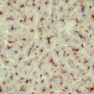 Immunohistochemistry (IHC) : Human liver stained with anti-CEA polyclonal antibody using peroxidase-conjugate and DAB chromogen. Note the canalicular staining pattern.