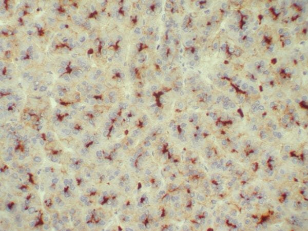 Immunohistochemistry (IHC) : Human liver stained with anti-CEA polyclonal antibody using peroxidase-conjugate and DAB chromogen. Note the canalicular staining pattern.