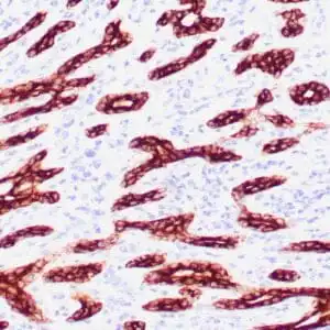 Immunohistochemistry (IHC) : Human breast stained with antibody CAM 5.2 using peroxidase-conjugate and DAB chromogen. Note the cytoplasmic staining of ductal cells.