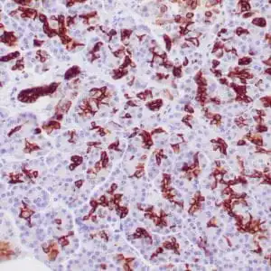 Immunohistochemistry (IHC) : Human pancreatic ducts stained with anti-keratin 19 antibody using peroxidase-conjugate and DAB chromogen. Note the cytoplasmic staining of ductal cells.