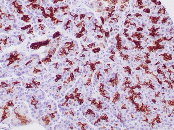 Immunohistochemistry (IHC) : Human pancreatic ducts stained with anti-keratin 19 antibody using peroxidase-conjugate and DAB chromogen. Note the cytoplasmic staining of ductal cells.