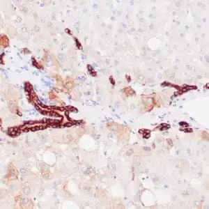Immunohistochemistry (IHC) : Human liver stained with anti-keratin 8/18 antibody using peroxidase-conjugate and DAB chromogen. Note the cytoplasmic staining of ductal cells (strong) and hepatocytes (weak).