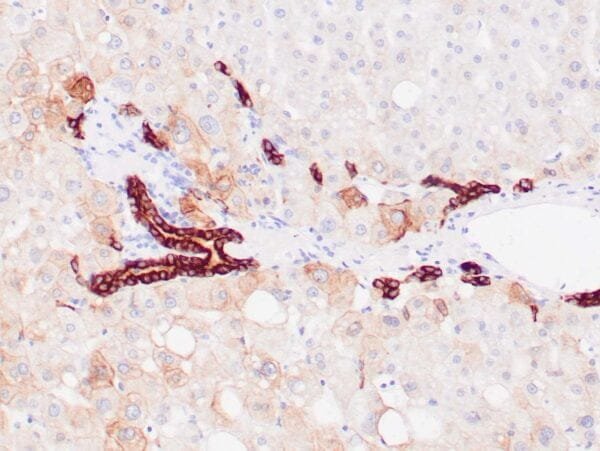 Immunohistochemistry (IHC) : Human liver stained with anti-keratin 8/18 antibody using peroxidase-conjugate and DAB chromogen. Note the cytoplasmic staining of ductal cells (strong) and hepatocytes (weak).