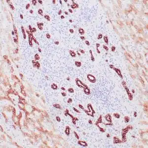 Immunohistochemistry (IHC) : Human liver stained with anti-keratin 8/18 antibody using peroxidase-conjugate and DAB chromogen. Note the cytoplasmic staining of hepatocytes (weak) and bile ducts (strong).