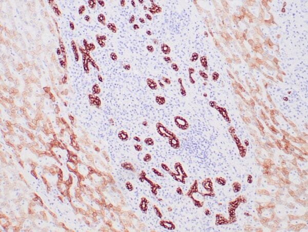 Immunohistochemistry (IHC) : Human liver stained with anti-keratin 8/18 antibody using peroxidase-conjugate and DAB chromogen. Note the cytoplasmic staining of hepatocytes (weak) and bile ducts (strong).