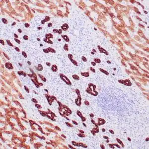 Immunohistochemistry (IHC) : Human liver stained with anti-pan cytokeratin OSCAR antibody using peroxidase-conjugate and DAB chromogen. Note the cytoplasmic staining of ductal cells (strong) and  hepatocytes (weak).
