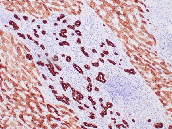 Immunohistochemistry (IHC) : Human liver stained with anti-pan cytokeratin OSCAR antibody using peroxidase-conjugate and DAB chromogen. Note the cytoplasmic staining of ductal cells (strong) and  hepatocytes (weak).