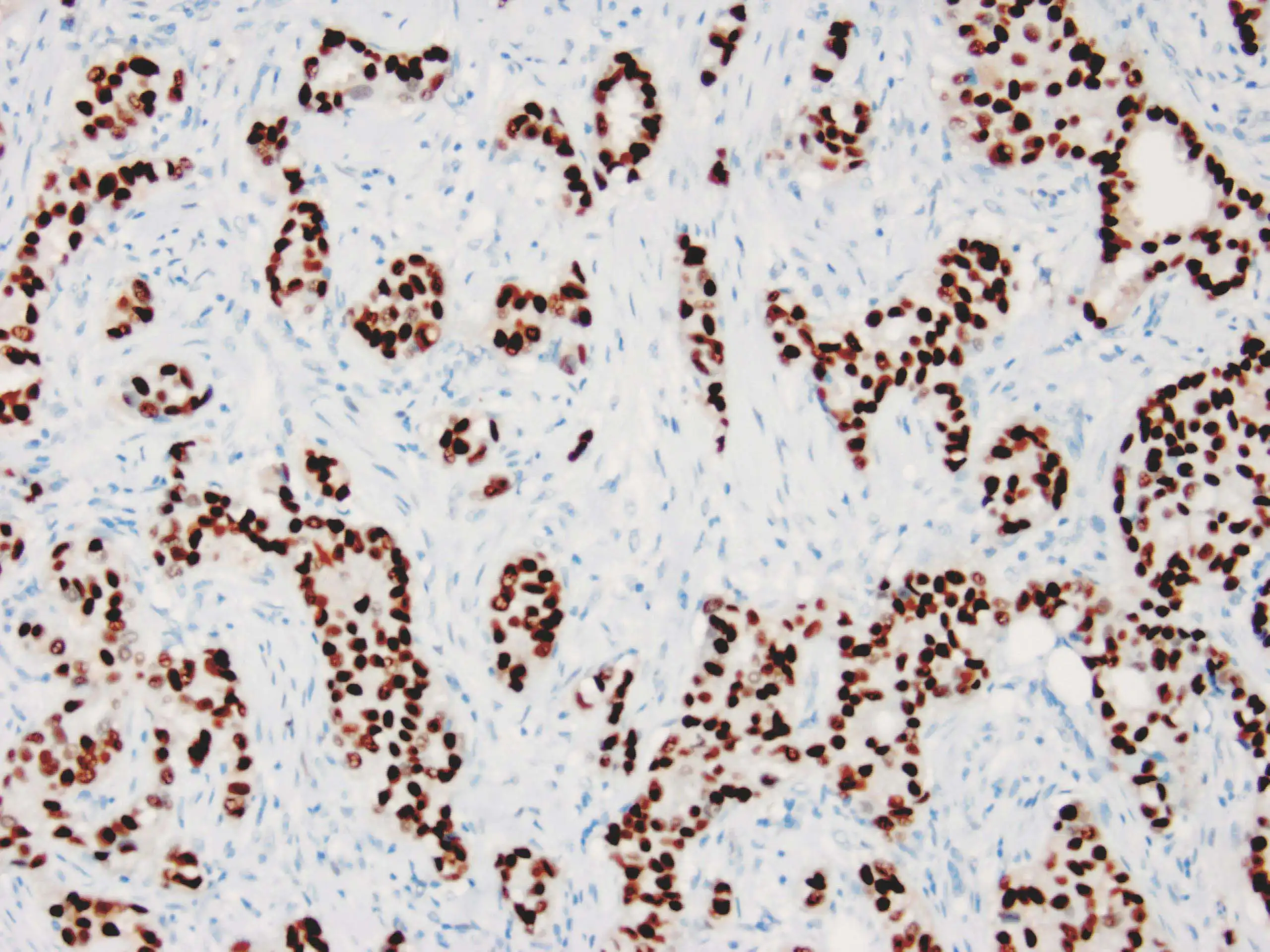 Rabbit Anti-ER monoclonal antibody (ZR2) 6176