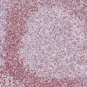 Immunohistochemistry (IHC) : Human tonsil stained with anti-FoxP1 antibody using peroxidase-conjugate and DAB chromogen. Note the nuclear staining of follicular and mantle B-cells.