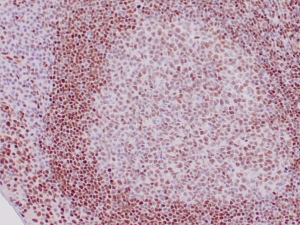 Immunohistochemistry (IHC) : Human tonsil stained with anti-FoxP1 antibody using peroxidase-conjugate and DAB chromogen. Note the nuclear staining of follicular and mantle B-cells.