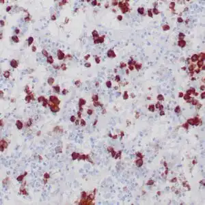 Immunohistochemistry (IHC) : Formalin-fixed, paraffin-embedded human normal pituitary stained with anti-FSH antibody using peroxidase-conjugate and DAB chromogen. Note the cytoplasmic staining of FSH secreting cells