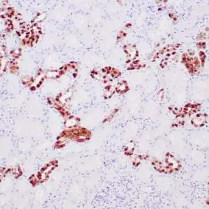 Immunohistochemistry (IHC) : Human kidney stained with anti-Galectin-3 antibody using peroxidase-conjugate and DAB chromogen. Note the cytoplasmic staining of tubular cells.