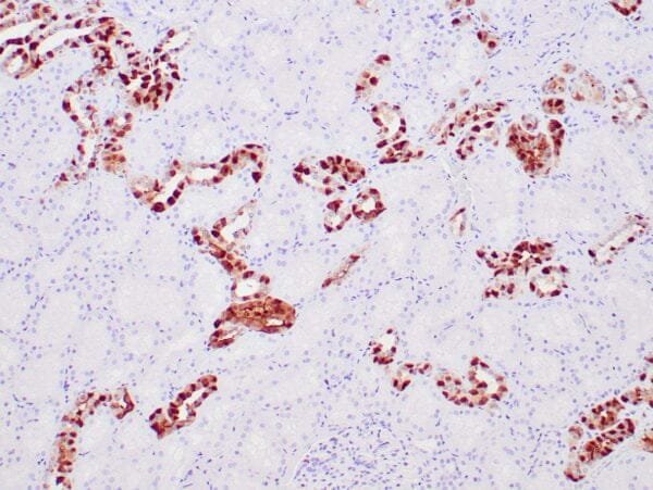 Immunohistochemistry (IHC) : Human kidney stained with anti-Galectin-3 antibody using peroxidase-conjugate and DAB chromogen. Note the cytoplasmic staining of tubular cells.