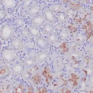 Immunohistochemistry (IHC) : Formalin-fixed, paraffin-embedded human gastric antral mucosa stained with anti-gastrin antibody using peroxidase-conjugate and DAB chromogen. Note the cytoplasmic staining of few G-cells