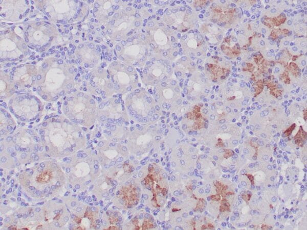 Immunohistochemistry (IHC) : Formalin-fixed, paraffin-embedded human gastric antral mucosa stained with anti-gastrin antibody using peroxidase-conjugate and DAB chromogen. Note the cytoplasmic staining of few G-cells