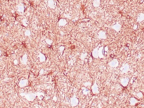 Immunohistochemistry (IHC) : Human brain stained with anti-GFAP antibody using peroxidase-conjugate and DAB chromogen. Note positive staining of astrocytic processes.