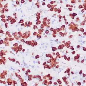Immunohistochemistry (IHC) : Human pancreas stained with anti-Glucagon antibody using peroxidase-conjugate and DAB chromogen. Note the cytoplasmic staining of islet cells.