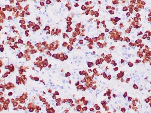 Immunohistochemistry (IHC) : Human pancreas stained with anti-Glucagon antibody using peroxidase-conjugate and DAB chromogen. Note the cytoplasmic staining of islet cells.