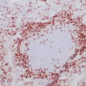 Immunohistochemistry (IHC) : Human tonsil stained with anti-Granzyme B antibody using peroxidase-conjugate and DAB chromogen. Note cytoplasmic granular staining of cytotoxic T-cells.