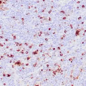 Immunohistochemistry (IHC) : Human tonsil stained with anti-Granzyme B antibody using peroxidase-conjugate and DAB chromogen. Note cytoplasmic granular staining of cytotoxic T-cells.
