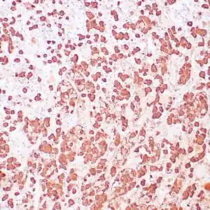 Immunohistochemistry (IHC) : Human pituitary stained with anti-GH antibody using peroxidase-conjugate and DAB chromogen. Note the cytoplasmic staining of glandular cells.