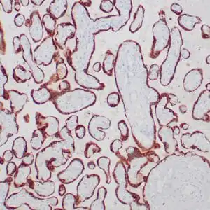Immunohistochemistry (IHC) : Formalin-fixed, paraffin-embedded human placenta stained with anti-HCG-beta antibody using peroxidase-conjugate and DAB chromogen. Note the cytoplasmic staining of trophoblasts