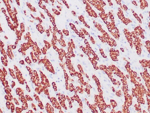 Immunohistochemistry (IHC) : Human liver stained with anti-HepPar-1 antibody using peroxidase-conjugate and DAB chromogen. Note the cytoplasmic staining of hepatocytes.