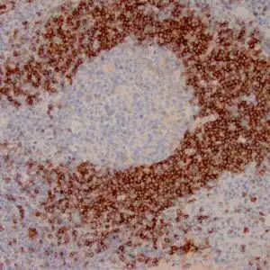 Immunohistochemistry (IHC) : Formalin-fixed, paraffin-embedded human lymph node stained with anti-IgD antibody using peroxidase-conjugate and DAB chromogen. Note cytoplasmic staining of mantle B cells
