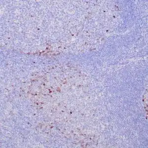 Immunohistochemistry (IHC) : Formalin-fixed, paraffin-embedded human tonsil stained with anti-IgG antibody using peroxidase-conjugate and DAB chromogen. Note cytoplasmic staining of plasma cells