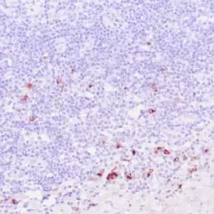 Immunohistochemistry (IHC) : Human tonsil stained with anti-IgG4 antibody using peroxidase-conjugate and DAB chromogen. Note the cytoplasmic staining of plasma cells.