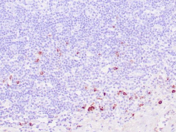 Immunohistochemistry (IHC) : Human tonsil stained with anti-IgG4 antibody using peroxidase-conjugate and DAB chromogen. Note the cytoplasmic staining of plasma cells.