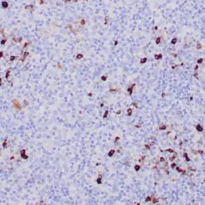 Immunohistochemistry (IHC) : Formalin-fixed, paraffin-embedded human tonsil stained with anti-IgM antibody using peroxidase-conjugate and DAB chromogen. Note cytoplasmic staining of plasma cells